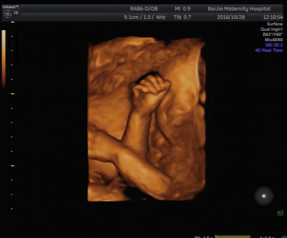 上海百佳妇产医院